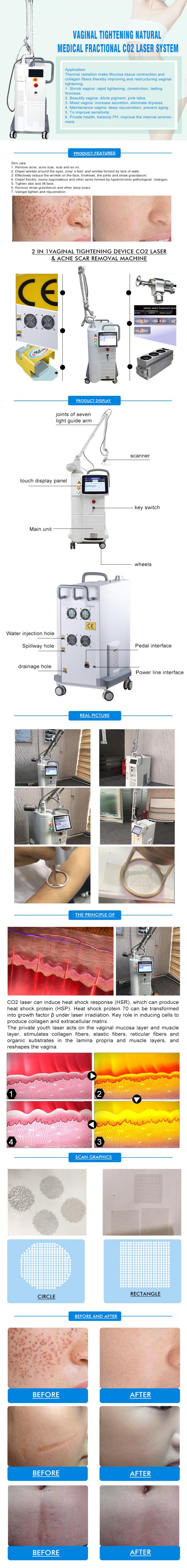 Le plus tard machine 2022 partielle de laser de CO2 de CO2 d'équipement de laser de CO2 partiel partiel de laser