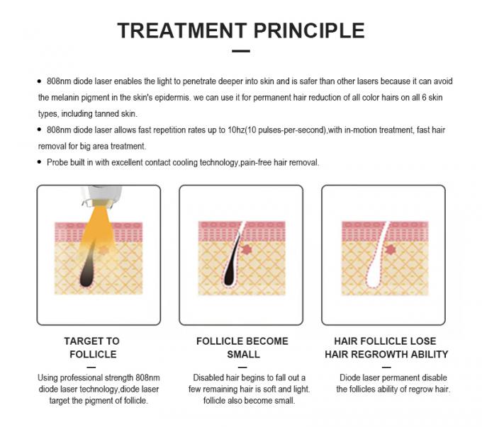Máquina de láser de diodo de titanio de hielo longitud de onda triple 755 808 1064Nm Diodo láser de depilación 7