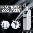 Scar Removal Fractional Co2 Laser Machine