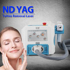 6ns Portable 1064nm/532nm ND YAG Laser Tattoo Removal Machine