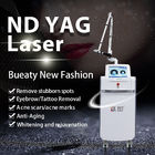532nm Q Switched Nd Yag Laser Tattoo Removal Machine