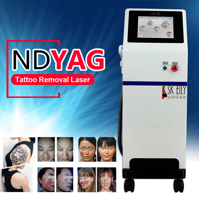 532Nm ND YAG Laser Tattoo Removal Machine